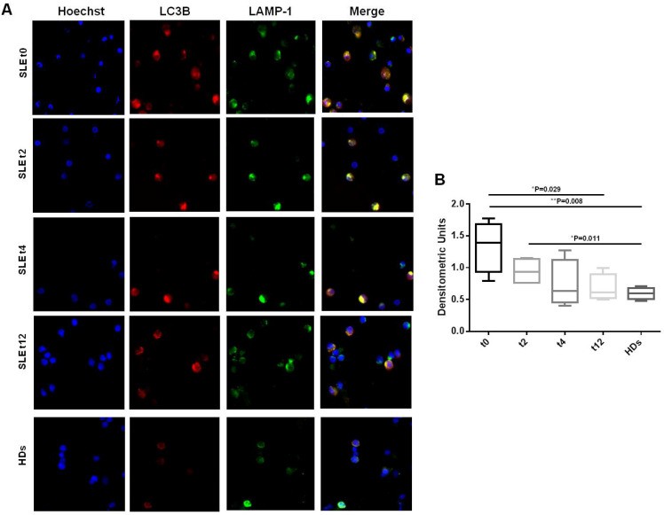 Confocal immunofluorescence showing co-localisation of LC3B (green, autophagosome marker) and LAMP-1 (red, lysosomal marker) in human peripheral blood mononuclear cells, with punctate LC3B foci indicating autophagic vesicles adjacent to lysosomes. (Homo sapiens (peripheral blood mononuclear cells).)