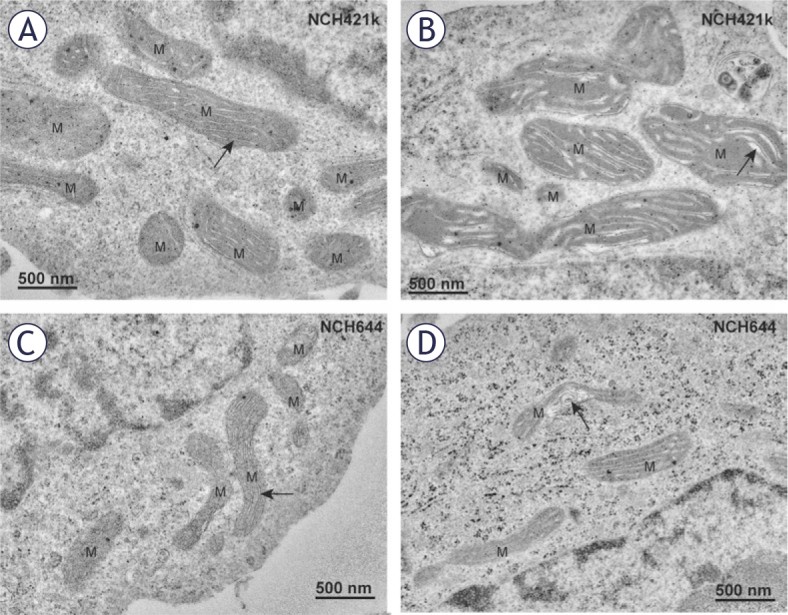 Transmission electron micrograph of a human glioblastoma stem cell showing electron-dense mitochondria (M) with narrow elongated cristae, illustrating the heterogeneous mitochondrial ultrastructure of these cells. (Homo sapiens (glioblastoma stem cells).)