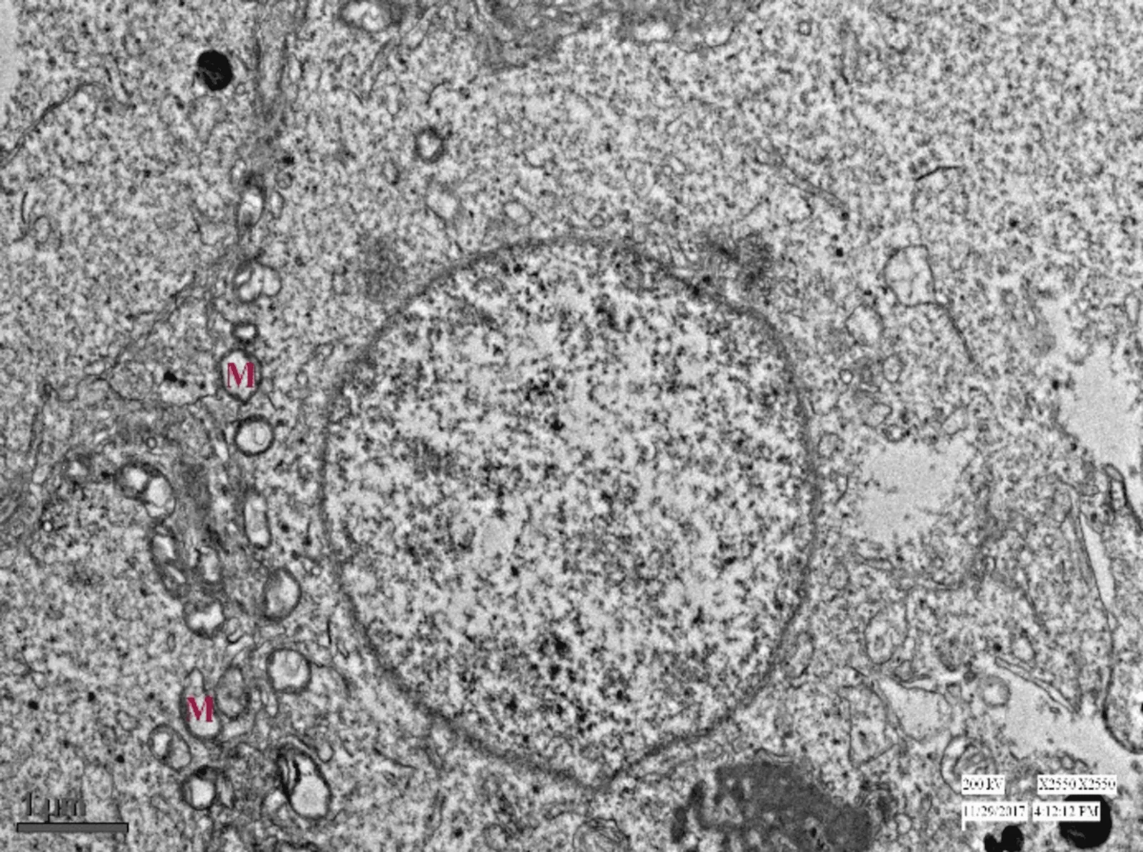 Transmission electron microscopy Normal Leydig cells with no cytoplasmic vacuolation (M) are visible
