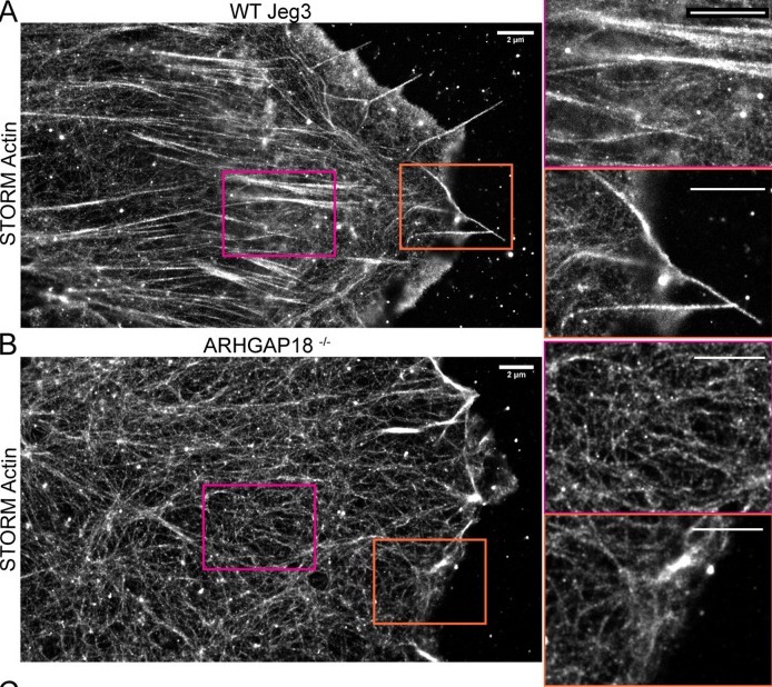 STORM Reconstruction of Individual Actin Architecture in WT and ARHGAP18 KO Jeg-3 Cells. A) STORM reconstructions of phalloidin stained actin in fixed Jeg-3 WT cells. Scale bar 2 µm; inset 2 µm. B) STORM reconstructions of phalloidin stained actin in fixed ARHGAP18 KO Jeg-3 cells. Scale bar 2 µm; inset 2 µm. (human (Jeg-3 choriocarcinoma cells); FIGURE 2, panels A-B (STORM actin reconstructions; rows 3-620 of figure).)