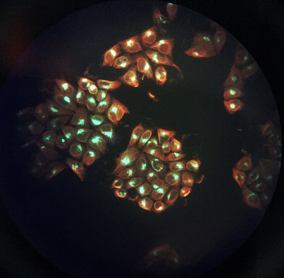 HeLa cells with actin filaments in red and microtubules in green. A wide field down the eyepiece rather than a confocal section, so individual filaments are not resolved and the nuclei dominate; it shows where the networks sit in a cell, not what a filament looks like.