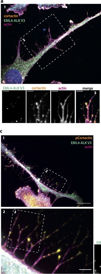 EML4-ALK V3, actin and phosphorylated cortactin colocalise in filopodia-like extensions. (A) Beas-2B cells were induced to express YFP-EML4-ALK V3 for 72 h before being fixed and stained with antibodies against cortactin (yellow). Actin was stained with TRITC-phalloidin (magenta), while DNA was stained with Hoechst 33,258 (blue). Expressed YFP was visualised (cyan). Magnified views are shown in panel (2) and (3), with the cell body, filopodia-like extensions (FLEs) and branch-points on the FLEs indicated. Scale bars, 10 um (1) and 5 um (2,3). (C) Beas-2B cells were induced to express EML4-ALK V3 before being fixed and stained with antibodies against phosphorylated cortactin (pCortactin, yellow). Actin was stained with TRITC-phalloidin (magenta), while DNA was stained with Hoechst 33258 (blue). Expressed YFP was visualised (cyan). Scale bars, 10 um (1) 5 um (2,3).