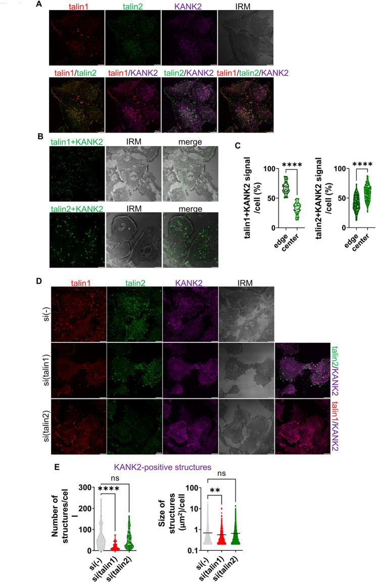 KANK2 localizes with talin1 at the cell edge, and with talin2 in the cell centre. A, KANK2 localizes in talin1 and talin2-positive adhesions. Forty-eight hours after seeding RPMI-7951 cells were methanol fixed, and stained with anti-talin1 antibody (red), anti-talin2 antibody (green) and anti-KANK2 antibody (grey/magenta). Scale bar: 20 um.