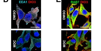 SNX6-SNX2 are distributed with DIO3 during endocytosis. Confocal immunofluorescence microscopy of ES-2 cells under 100 µM MDC for 3 h, in DMSO and MDC conditions: DIO3 (red) with (D) EEA1 (far red, shown in cyan) and (E) RAB7 (green). Scale bars: 20 μm.