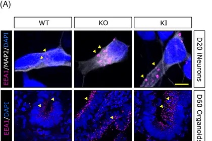 Enlargement and altered distribution of early endosomes in SORL1 p.Y1816C and KO neurons and organoids. (A) Representative immunofluorescence images showing EEA1-positive early endosomes in WT, SORLA KO, and KI 2D neurons at day 20 and 3D cerebral organoids at day 60;