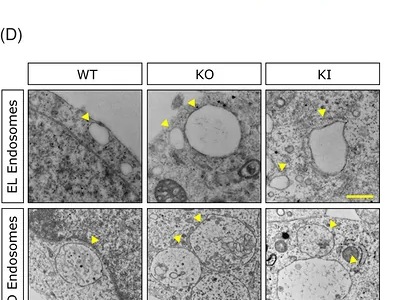 Enlargement and altered distribution of early endosomes in SORL1 p.Y1816C and KO neurons and organoids. (D) Representative TEMs of EL and ED endosomes in WT, KI, and KO neurons;