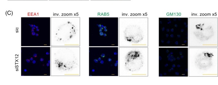 STX12 depletion disrupts early endocytic trafficking in GSCs. (C) Confocal imaging of EEA1 (red), RAB5 (green), and GM130 (green) in control and STX12-depleted cells, in sic or siSTX12-transfected cells. Nuclear staining with DAPI is shown in blue. Corresponding higher-magnification insets with inverted grayscale are shown on the right. Scale bars: 10 um.