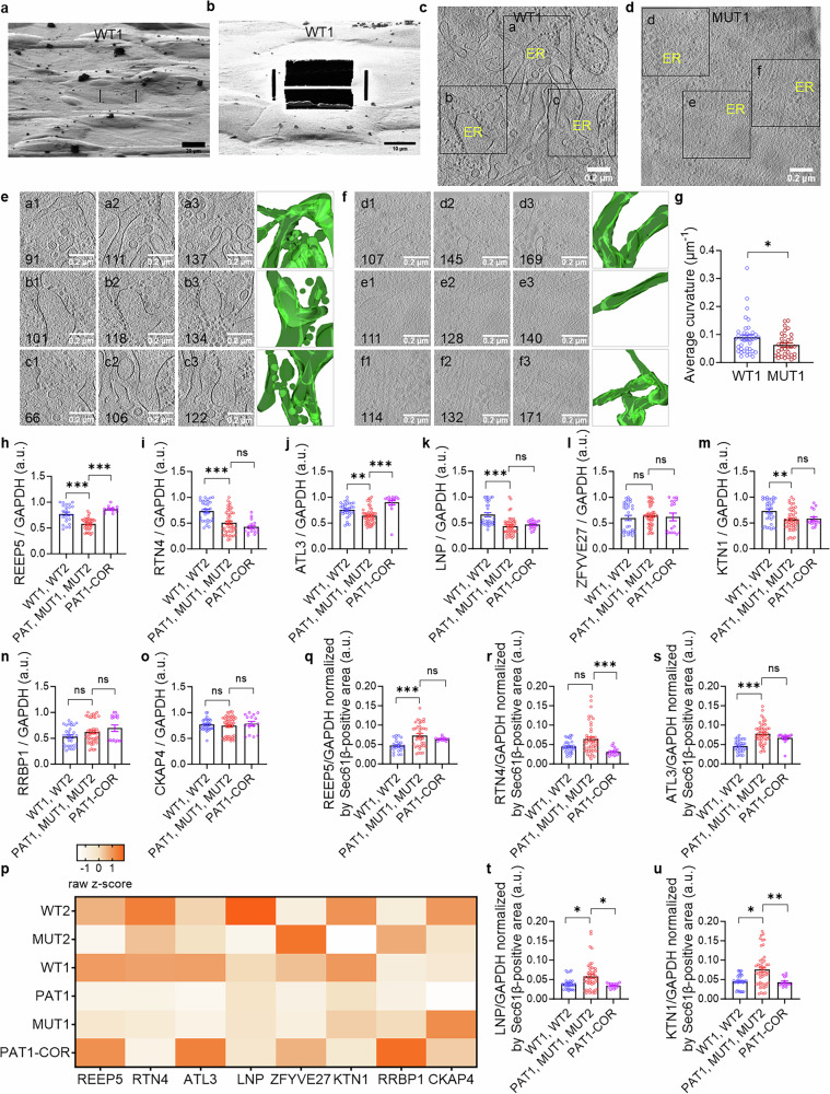 The ER architecture of DCM (MUT) iPSC-CMs is dysfunctional due to loss of membrane curvature. a – e Visualization of the ER membrane curvature in TPM1-L185F (MUT1) iPSC-CMs compared with isogenic control iPSC-CMs by cryo-electron microscopy. a Vitrified healthy control (WT1) iPSC-CM attached to the electron microscopy grid. Scale bar, 20 µm. b Cross-sectional lamella preparation using cryo-focused