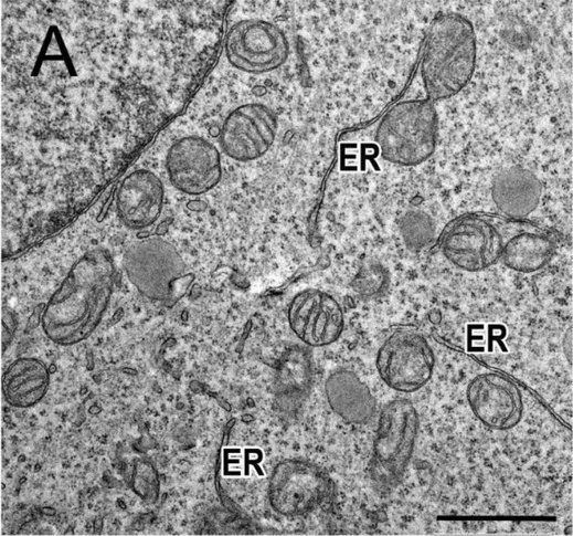 Long narrow ER membranes in the control Phoenix cell line, panel A of a figure on ultrastructural aspects of ER stress in mutant Δ2-4VPS13B clones. Scale bar: 1 µm. ER, endoplasmic reticulum. (human (Phoenix cells, control condition); Figure 6, A (control).)