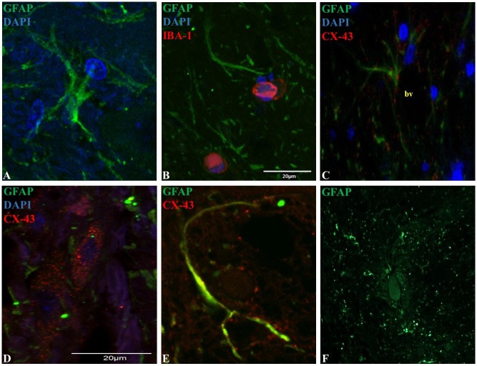 Representative epifluorescence and confocal images of longitudinal sections of spinal cord dorsal horn in healthy horses. The sections were double immune-labeled against GFAP (green), Cx-43 (red) and DAPI (blue) to detect astrocytes, and double immune-labeled against GFAP (green), Iba-1 (red) and DAPI (blue) to detect astrocytes and microglial cells. (horse; Figure 2.)
