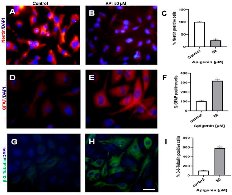 Immunofluorescence of U-251 human glioblastoma cells showing GFAP (mature astrocytic marker) and nestin (immature progenitor marker). Vehicle-control cells at standard culture density. Nuclei counterstained with DAPI. (Homo sapiens (U-251 glioblastoma cell line).)