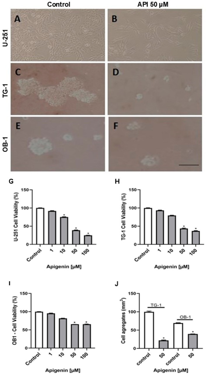 Phase contrast micrographs of U-251, TG-1, and OB-1 human glioblastoma cell lines under standard culture conditions showing spindle and polygonal morphology typical of glioma cells in monolayer. Vehicle-control wells. (Homo sapiens (U-251, TG-1, OB-1 glioblastoma cell lines).)