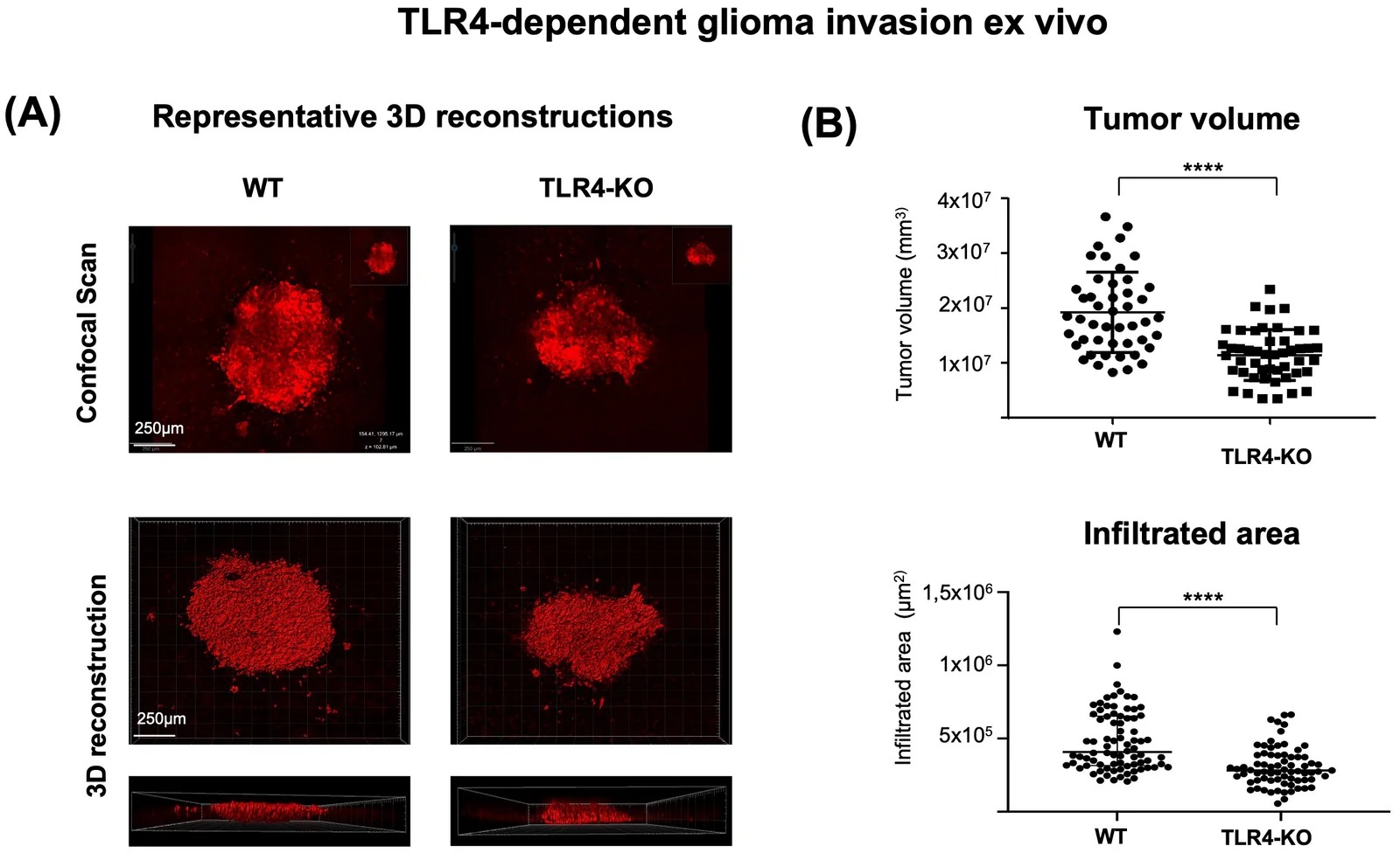 Host TLR4 deficiency reduces glioma expansion and invasion in organotypic brain slices. (A) Representative confocal scans and 3D reconstructions of organotypic brain slices (OBS) labeled with mCherry GL261 glioma cells from WT (n = 7) and TLR4-KO (n = 6) mice. OBS were obtained from 14-16-day-old C57BL/6 mice and inoculated with 5,000 GL261-mCherry cells. Scans were performed with a Leica SPE confocal microscope using a 10x magnification 5 days after injection. Scale bars: 500 um. (B) Quantification of tumor volume (top) and tumor surface infiltration area (bottom) from 3D reconstructions of mCherry fluorescence signal. Both tumor volume and infiltration area were significantly reduced in TLR4-KO slices compared with WT controls. (Figure 2.)