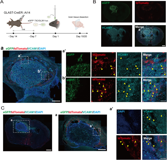 VCAM1 is expressed in a subset of GLAST+ astrocytes in glioma-bearing mice. (A) Experimental timeline for glioma cell implantation in GLAST-CreER::Ai14 mice. Mice received daily intraperitoneal injections of tamoxifen (TAM) for one week, followed by a one-week resting period. On day 1, 5,000-6,000 eGFP+ 73C or GL261-luc glioma cells were implanted beneath the hippocampus. Tumor-bearing mice were harvested on day 10 (eGFP+ 73C) or day 20 (GL261-luc). (B) Immunofluorescence staining of VCAM1 in eGFP+ 73C gliomas at day 10 post-implantation of GLAST-CreER::Ai14 mice. Scale bars: (B) 1 mm; (a), 500 um; (a', b'), 100 um. (C) Immunofluorescence staining of VCAM1 in GL261-luc gliomas at day 20 post-implantation of GLAST-CreER::Ai14 mice. Scale bars: (C) 1 mm; (a), 500 um; (a'), 100 um. (Figure 3.)
