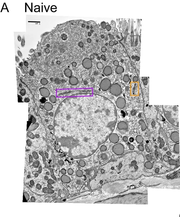 Electron microscopic analysis of Golgi structure in mouse airway secretory cells. Cellular profiles were compiled from multiple electron micrographs of secretory cells in mouse axial bronchi to include apical, basal, and lateral plasma membranes as well as a portion of the nucleus. (A) Representative airway secretory cell of a naïve mouse. The Golgi ribbon is outlined in purple, a Golgi satellite is outlined in orange, and both are also shown at higher magnification. Scale bars, 1 µm. (mouse (airway secretory cells); Figure 2A.)