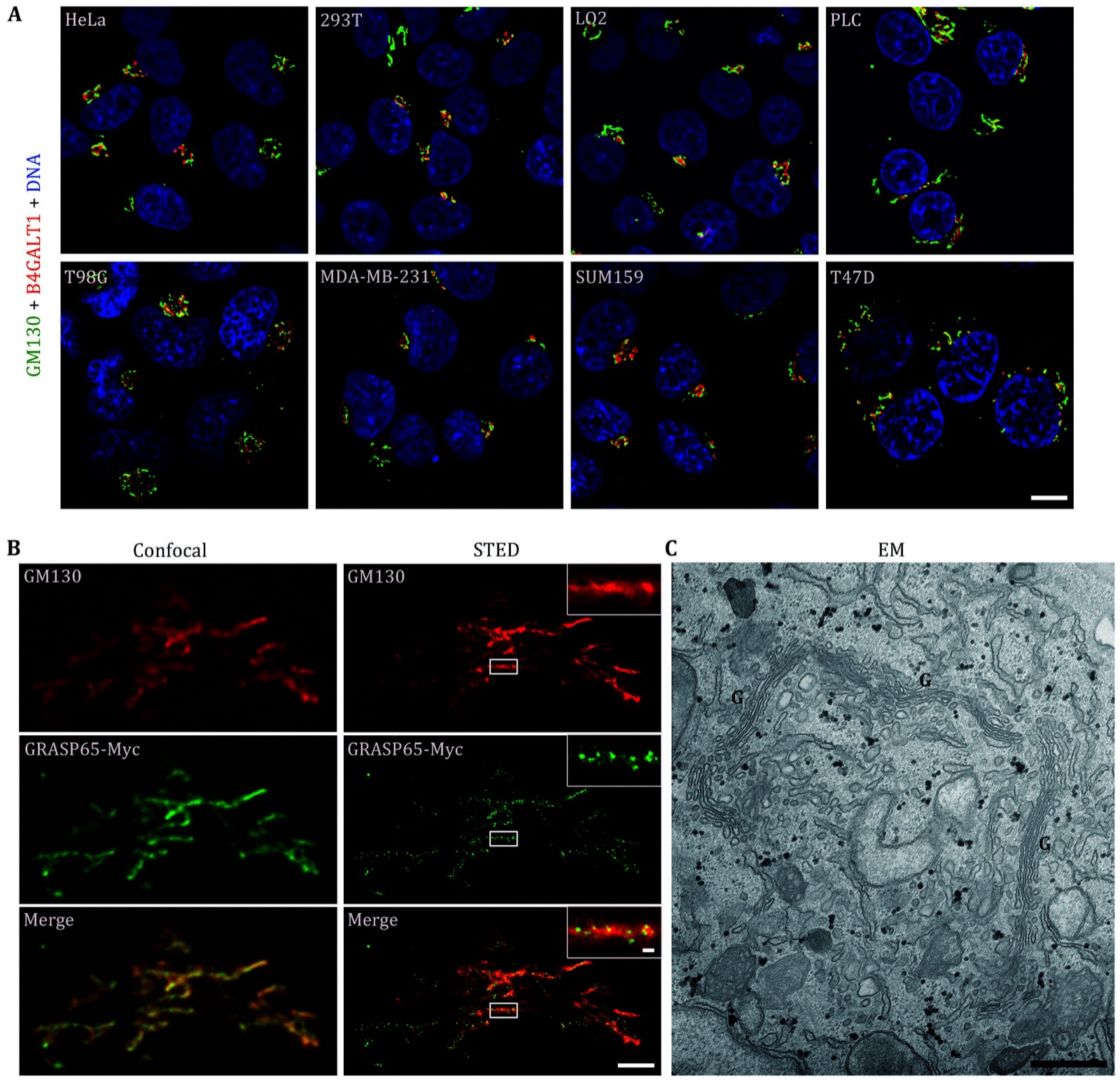 Images of the Golgi apparatus under different microscopy techniques. A Representative confocal microscopy images of the indicated cells demonstrated the variable morphology of the Golgi in different cell types. The cells were fixed and subsequently stained with antibodies against GM130 (a cis-Golgi marker, green) and B4GALT1 (a trans-Golgi marker, red). Scale bar, 10 um. B Representative images under additional microscopy techniques.