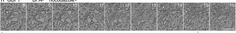 Dynamics of recycling endosomes (REs) in GBF1 M832L cells. h Scanning electron micrographs of serial sections of a Golgi stack with a 50-nm interval in a GBF1 M832L cell. The number in the top-right corner indicates the frame. Arrowheads indicate the ERES.