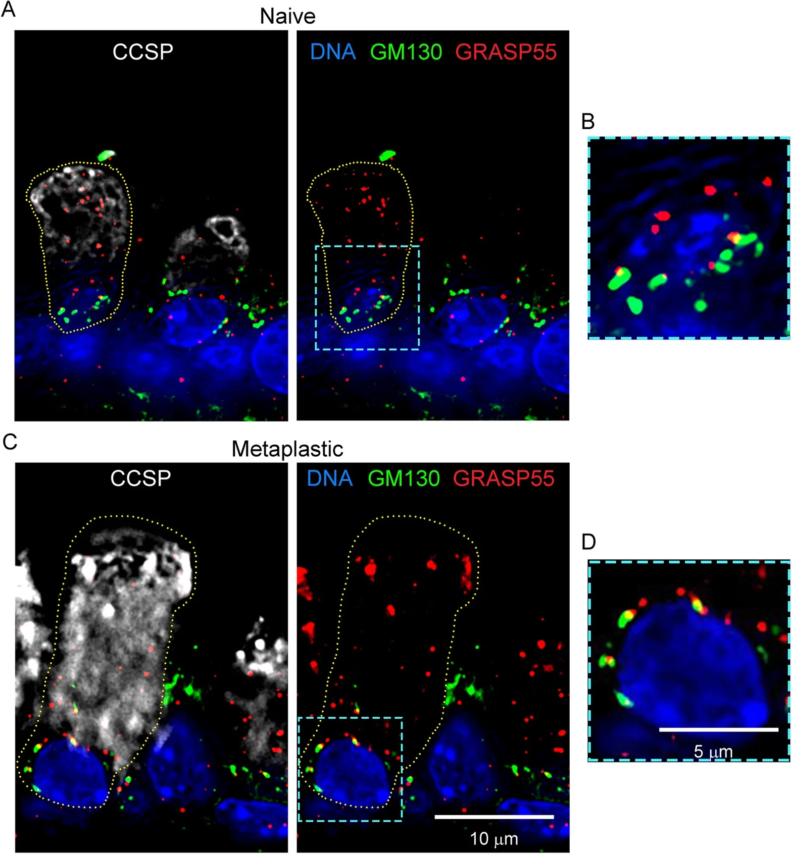 Localization of cis-Golgi and trans-Golgi cisternae in mouse airway secretory cells. (A) Immunofluorescence deconvolution microscopy using antibodies against club cell secretory protein (CCSP) to mark secretory cells, GM130 to mark cis-Golgi cisternae, GRASP55 to mark trans-Golgi cisternae, and DAPI stain to mark nuclei in the axial bronchus of naive mice. (B) The perinuclear area outlined in (A) is shown at higher magnification.