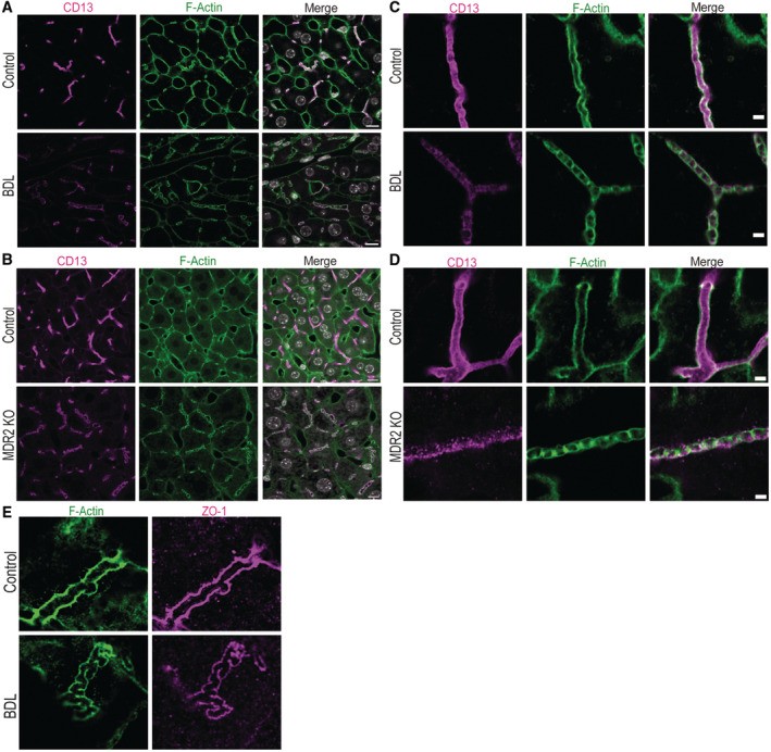 F-Actin co-localizes with the canalicular marker BSEP in bile canaliculi. Overview immunofluorescence images of human control liver tissue and liver from PSC patients showing BSEP-positive bile canaliculi with F-Actin co-staining. Both normal (control) and PSC-affected human hepatocytes are shown. (Homo sapiens; Figure S6 (extended data).)
