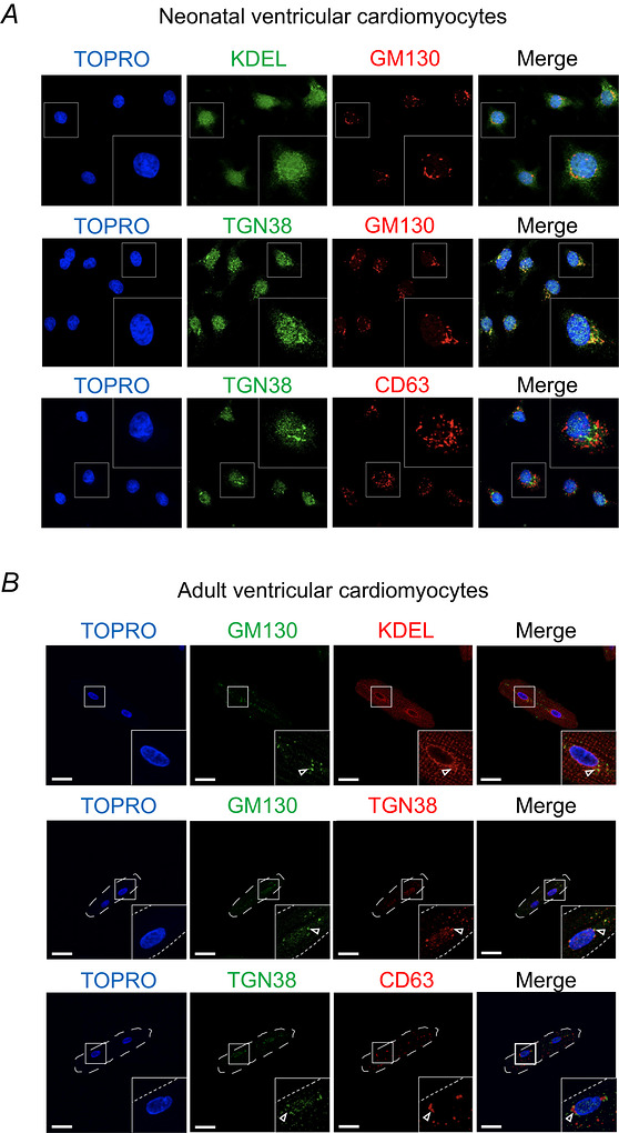 The classical secretory machinery and Golgi apparatus are predominantly localized to the perinuclear ER in neonatal and adult cardiac myocytes A, coimmunofluorescence labelling of neonatal rat ventricular myocytes with antibodies to the ER marker KDEL, the cis-Golgi marker GM130, the trans-Golgi marker TGN38 and the exosome marker CD63. B, coimmunofluorescence labelling of adult rat ventricular myocytes as described in (A). TOPRO, nuclei; scale bars = 20 um.