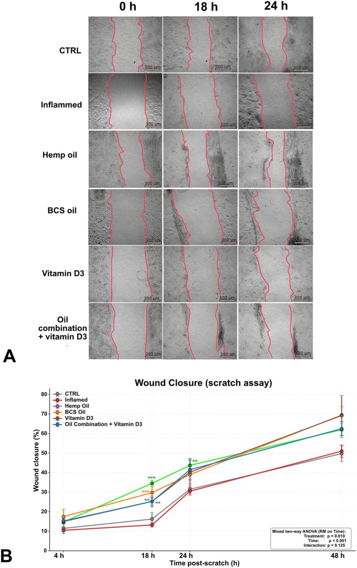 Effects of natural oil formulations and vitamin D3 on keratinocyte migration in an inflammatory scratch assay. Keratinocyte migration was assessed using a scratch assay performed in the presence of Ara-C to suppress proliferation and isolate migration-driven wound closure. (A) Representative phase-contrast images of scratch wounds at 0, 18, and 24 h post-scratch in control (CTRL), Inflamed, and treated groups (hemp oil, BCS oil, vitamin D3, and oil combination + vitamin D3). Yellow lines indicate the manually traced wound margins. Representative images at 0, 18, and 24 h are shown, corresponding to baseline and to the timepoints displaying the most pronounced between-group differences in the quantitative analysis; the complete time course (0, 4, 18, 24, and 48 h) is reported in panel (B). Scale bar: 200 um. (B) Quantification of wound closure (%) at 4, 18, 24, and 48 h. Data are presented as mean +/- SEM (n = 4 independent scratches per condition, across three independent experiments). (FIGURE 5.)