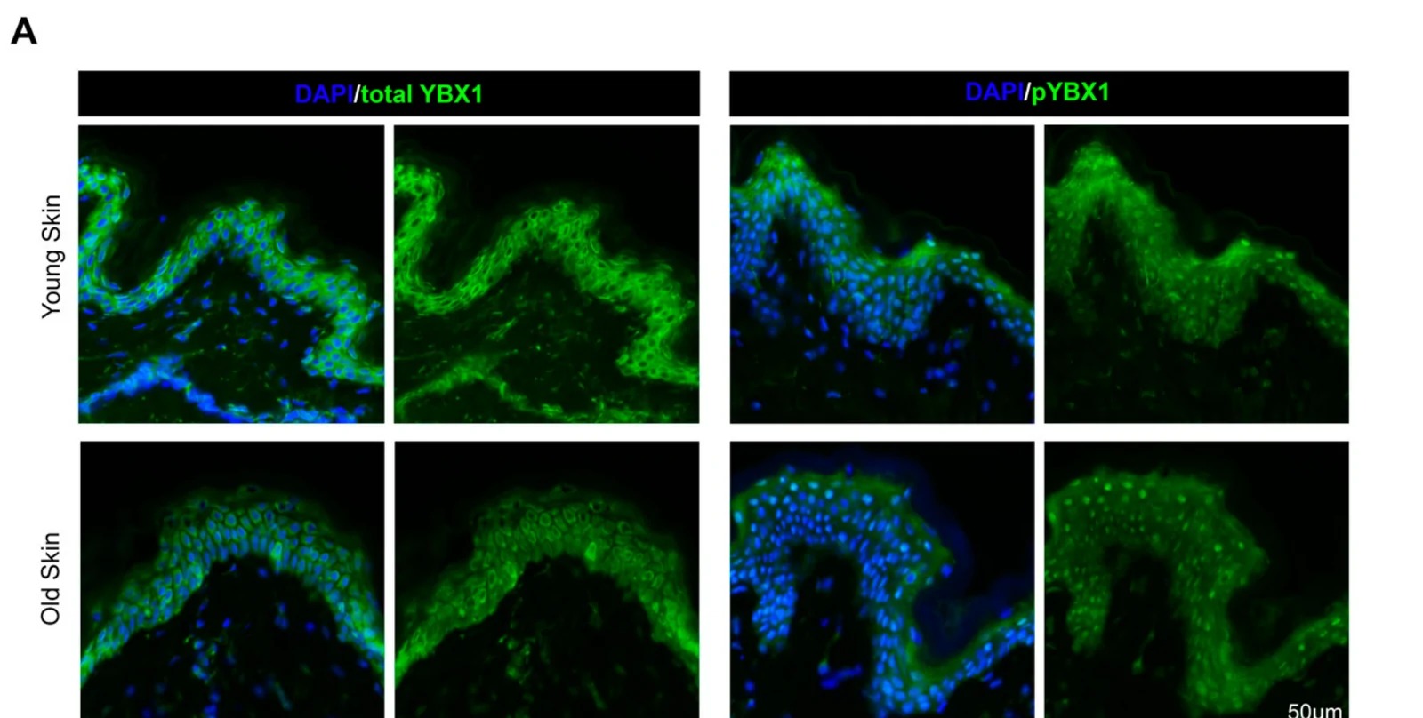 Representative immunofluorescence images of YBX1 (left panel, green), pYBX1 (right panel, green), and DAPI (blue) in young (upper panel) and old (lower panel) human skin samples. Scale bar, 50 um. (human; Figure 1, panel A (IF micrograph section; quantification panels B-E excluded; rows 0-808 of full figure).)