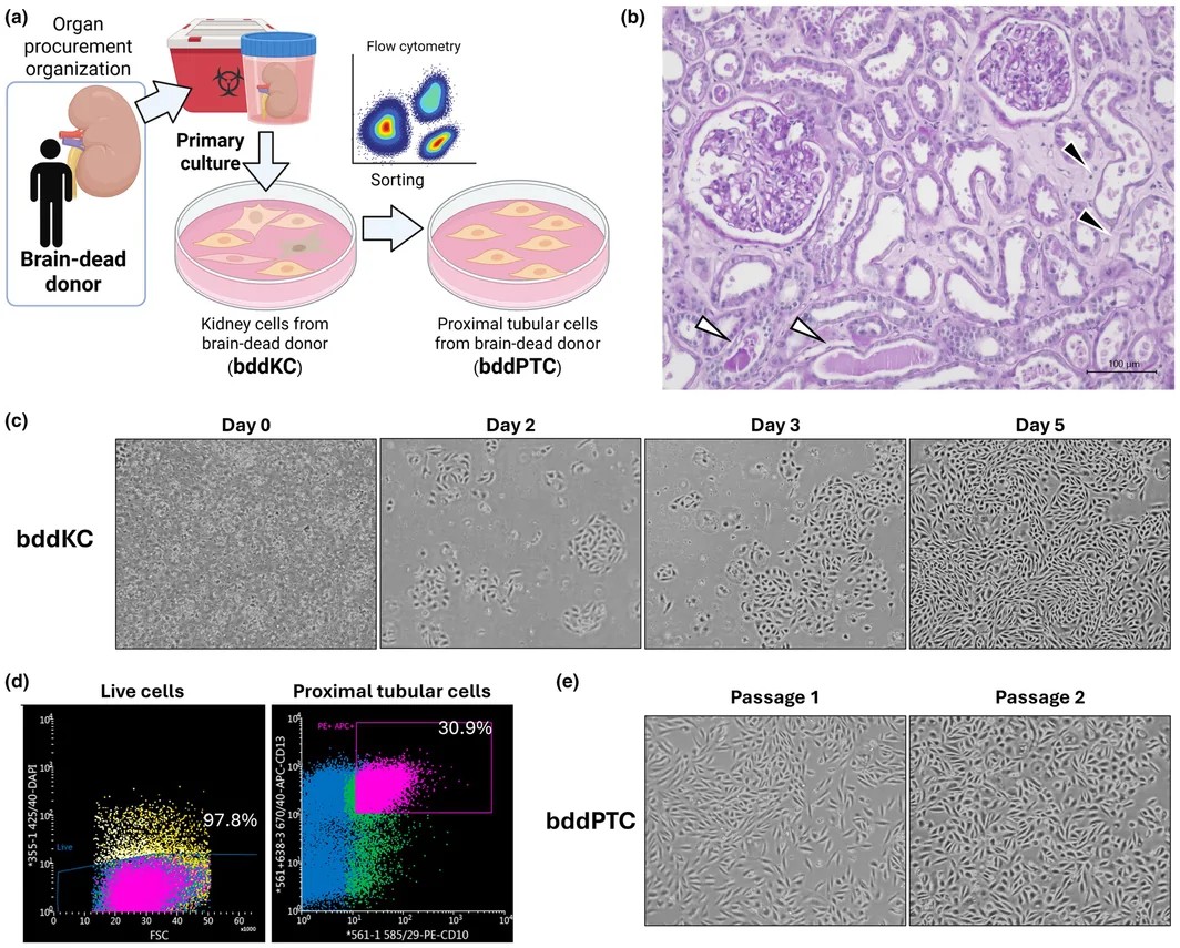 Immunofluorescence of human proximal tubule cells from a brain-dead donor kidney. Megalin (LRP2, a proximal tubule brush-border multi-ligand receptor) co-localizes with AQP1 (water channel of the apical brush border) at the apical membrane. Human donor kidney tissue showing normal proximal tubule architecture with apical marker co-expression. (Homo sapiens; Figure 2.)