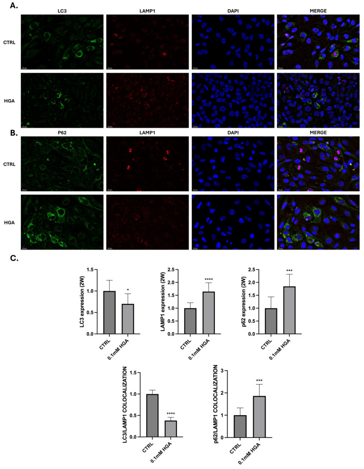 C20/A4 chondrocytes were treated with 0.1 HGA for 2 W. (A) LC3 (green) and LAMP1 (red) markers are both double-labeled. LAMP1 expression resulted increased, while decreased the expression of LC3 and its colocalization with LAMP1, in HGA treated cells compared to control. (B) p62 (green) and LAMP1 (red) are both double-labeled. p62 and LAMP1 expression, and their colocalization increase in HGA treated cells compared to control. Nuclei were counterstained with DAPI.
