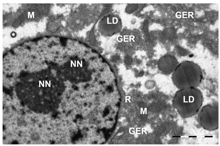 Structure of a camel liver hepatocyte. NN--nucleolus in the nucleus; LD--lipid droplet; M--mitochondria; GER--granular endoplasmic reticulum channels; R--ribosomes and polyribosomes. Electron microphotography. (Bactrian camel (Camelus bactrianus, liver hepatocyte); Figure 7single.)