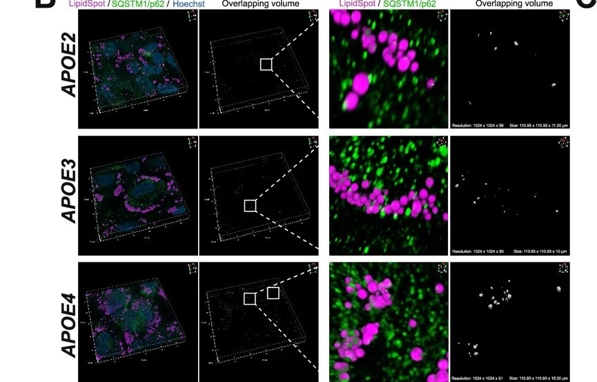 SQSTM1/p62 in green contacting LipidSpot-positive lipid droplets in magenta in KOLF2.1 J astrocytes; overlap volume is white. 3D projection: 110.93 x 110.93 x 10-11.20 um3. (human (KOLF2.1J iPSC-derived astrocytes); Figure 5, panel B (confocal IF micrographs only; bar chart panels A and C excluded; cols 270-1250 then 105-865 of full figure row).)