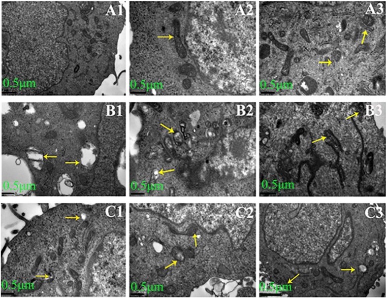 Transmission electron micrograph (TEM, ×12,000) of human lens epithelial cells (HLECs) in the control (normal glucose) group. The cells show intact cytoskeletal organization with visible actin filaments, normal mitochondria, and characteristic adherens junctions between adjacent epithelial cells. The lens epithelial cells form a monolayer that overlies the anterior lens capsule and are the precursors to lens fibre cells. (human (lens epithelial cells, HLEC cell line); Figure 1, A1.)