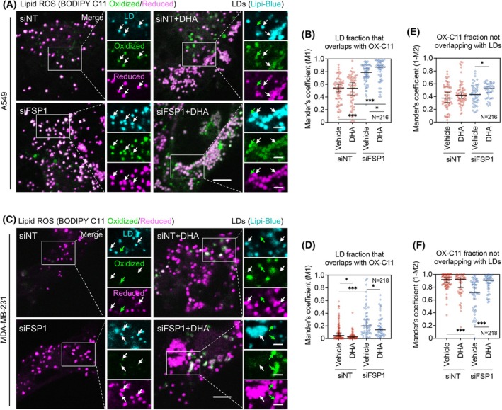 Lipid ROS localization reflects distinct roles of LDs in ferroptosis. (A) Representative confocal microscopy images of A549 cells co-stained with the BODIPY C11 581/591 lipid peroxidation sensor (oxidized, green; reduced, magenta) and the Lipi-Blue lipid droplet marker (cyan), following FSP1 silencing (siFSP1) and/or supplementation with 200 uM docosahexaenoic acid (DHA) for 24 h. Boxed insets show representative regions of a single cell displayed in three separate fluorescent channels. Lipid droplet localizations in all three channels are marked with white arrows. Green arrows mark oxidized probe signal that does not colocalize with lipid droplets. Scale bars, 5 μm and 2 μm (inset).