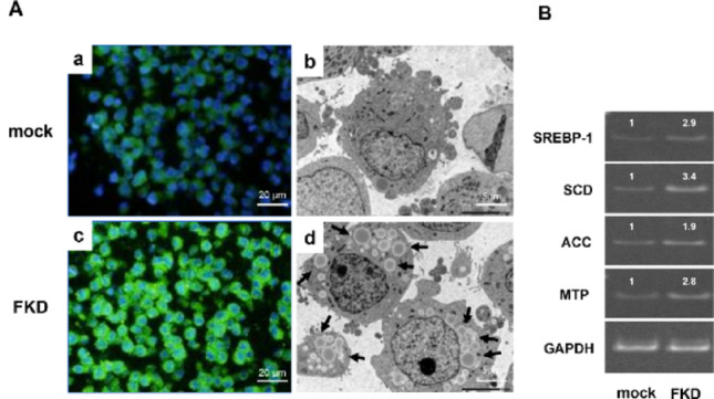 Lipid droplet accumulation and ultrastructural changes in FKD cells. A BODIPY staining revealed markedly increased cytoplasmic lipid droplets in FKD cells ( c ) compared with mock cells ( a ). Transmission electron microscopy (TEM) demonstrated numerous large lipid droplets and distorted cytoplasmic organelles in FKD cells ( d ) compared with mock cells ( b ). The arrows indicate lipid droplets within the cytoplasm. B Semiquantitative RT-PCR analysis showed upregulation of lipid metabolism-related genes (SREBP-1, SCD, ACC, MTP), indicating activation of lipogenic pathways following Fbxw7 depletion