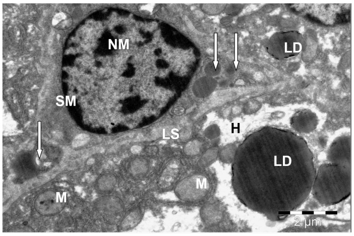 Stellate macrophage (Kupffer cell) in the liver of a camel. H--hepatocyte; SM--stellate macrophage; NM--macrophage nucleus; LS--sinusoid lumen; LD--lipid droplets; M--mitochondria; lysosomes and phagolysosomes (↑). Electron microphotography. (Bactrian camel (Camelus bactrianus, liver Kupffer cell); Figure 10single.)
