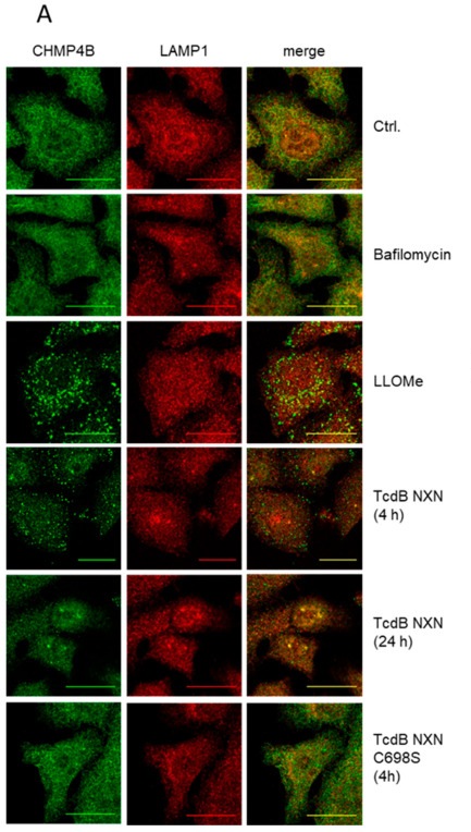 CHMP4B accumulates in response to TcdB remnants in endosomes. (A) Immunofluorescent staining against LAMP1 (red) and CHMP4B (green) as a marker for moderate endosome membrane damage showed accumulation of CHMP4B on endosomes of HEp-2 cells after treatment with positive control LLOMe (1 mM) as well as with 1 ug/mL TcdB NXN. Neither non-cleavable TcdB NXN C698S nor bafilomycin provoked CHMP4B accumulation. CHMP4B response was observed after 4 h treatment with TcdB NXN and barely visible after 24 h treatment.