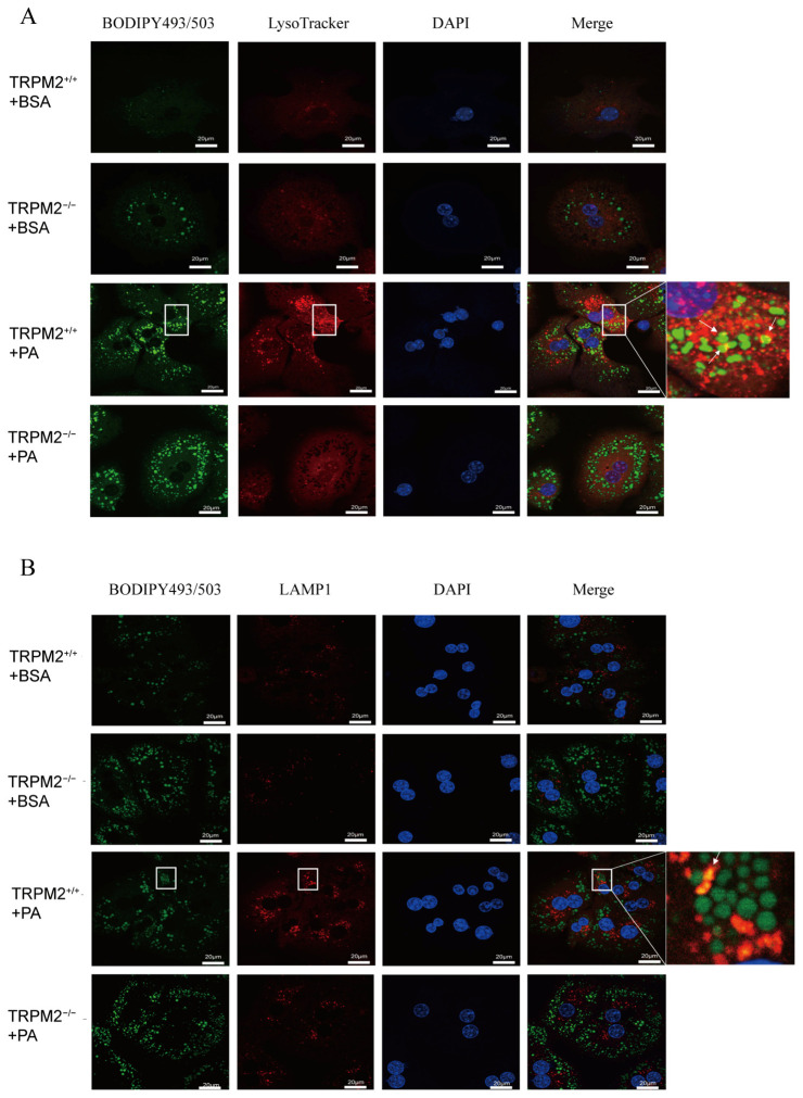 TRPM2 gene knockout reduced lysosomal abundance in PA-treated primary hepatocytes. The primary cultured hepatocytes from TRPM2 +/+ and TRPM2 -/- were treated with PA (250 uM for 24 h) to induce lipid accumulation or with BSA as a control. (A) The cells were co-stained with lysosome marker LysoTracker and neutral lipid dye BODIPY493/503 or (B) with lysosome marker LAMP1 and BODIPY493/503. Scale bar = 10 um.