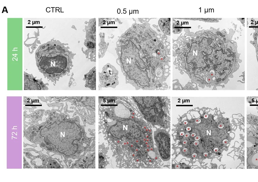 Ultrastructural analysis of MNPs uptake and intracellular fate in primary human monocytes. (A) Representative TEM images of freshly isolated monocytes at 24 and 72 hours post exposure to 25 µg/ml of MNPs with diameter of 0.5, 1, and 5 µm.