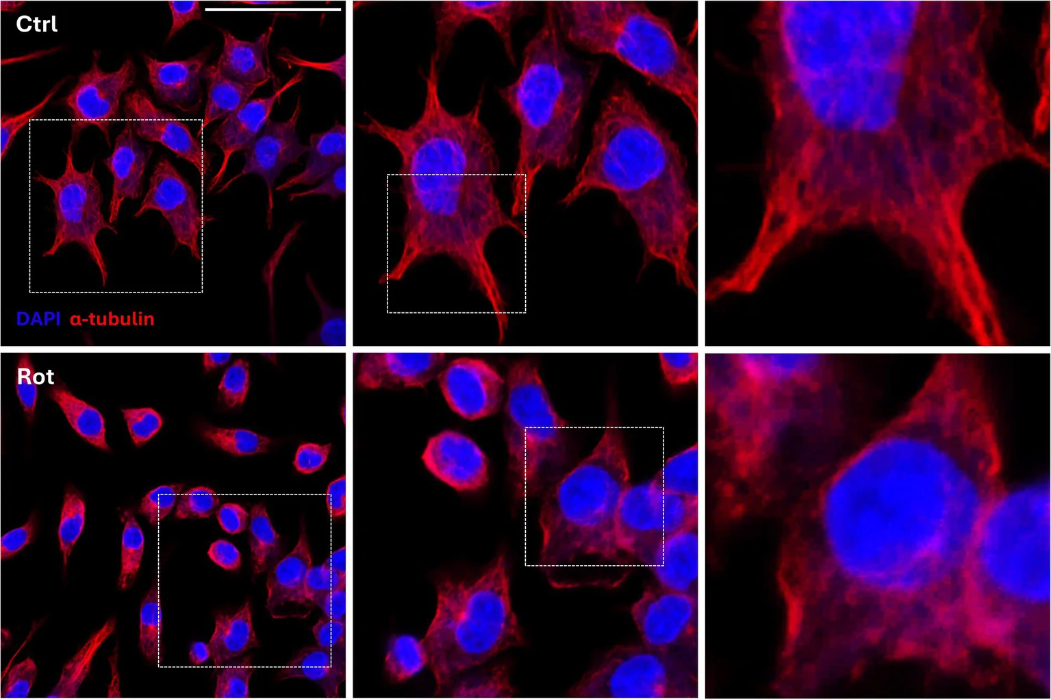 Rotenone affects tubulin organization. Representative fluorescence images of alpha-tubulin staining in control and 50 nM rotenone-treated BV2 cells, with DAPI nuclear counterstaining. Magnification: 40x. Scale bar = 50 um.
