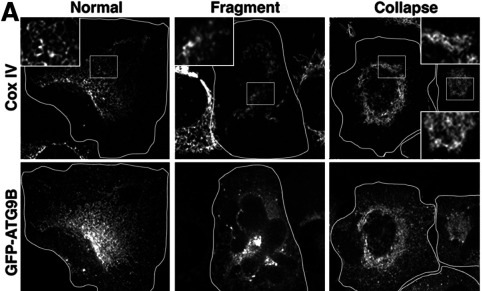 Overexpression of ATG9B disrupts mitochondrial morphology in H1299 cells. (A) Confocal images depicting H1299 cells stained for Cox IV and expressing GFP-ATG9B, illustrating three mitochondrial subtypes: normal, fragmented, and collapsed. Normal-looking mitochondria are characterized by well-defined, elongated tubular structures. Fragmented mitochondria display small, rounded, or punctate structures with noticeably reduced length compared with normal mitochondria and often with reduced Cox IV staining. Collapsed mitochondria exhibit perinuclear localization and diminished peripheral distribution.
