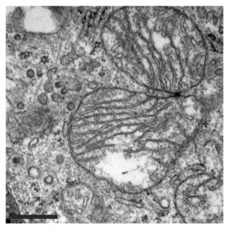 Transmission electron microscopy (TEM) image of mitochondria of a MEF cell in which the gene OMA1 has been knocked out. The cristae are clearly visible. Scale bar equivalent to 0.5 um.