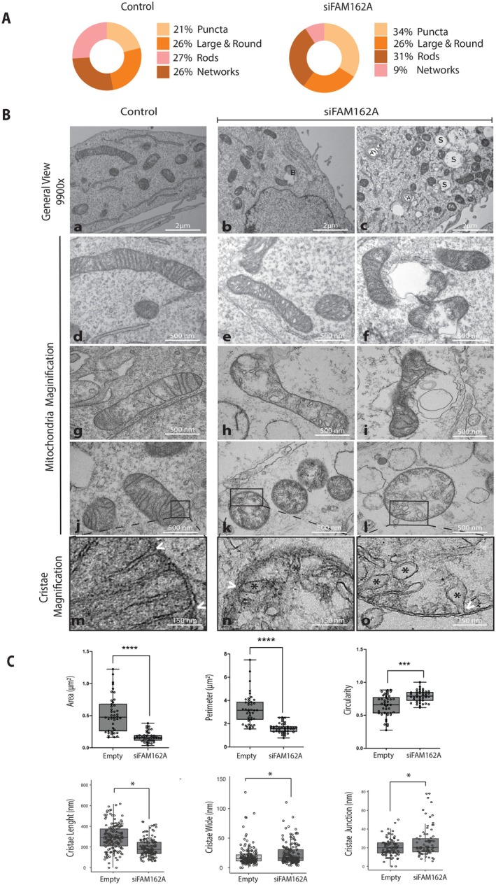 Loss of FAM162A Disrupts Mitochondrial Morphology and Cristae Ultrastructure. (A) Mitochondrial Morphology. Mitochondrial morphologies were analyzed from TMRE-stained siFAM162A and control cells followed by confocal live imaging and classified into four categories: Network, Rods, Puncta, and Large and Round. The pie charts present the percentage of cells falling into each category.
