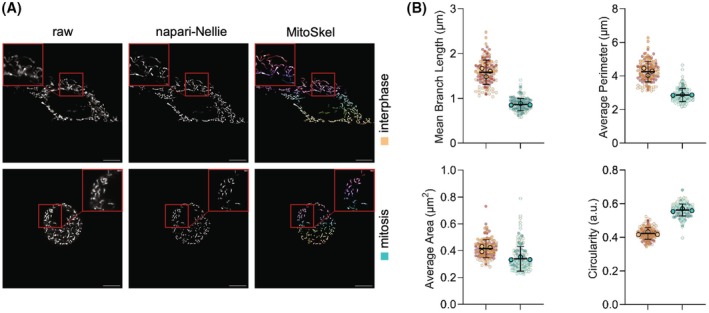 Application of RoundMi to mitochondrial morphology analysis in live-cell imaging. (A) Representative confocal images of live MEF ctrl cells during interphase and mitosis. Raw images, images pre-processed using Napari-Nellie, and the corresponding mitochondrial segmentations generated using MitoSkel are shown. Images were cropped in ImageJ/Fiji to provide a zoomed-in view. Mitochondria were labeled with a fluorescent mitochondria-specific dye for live cell imaging.
