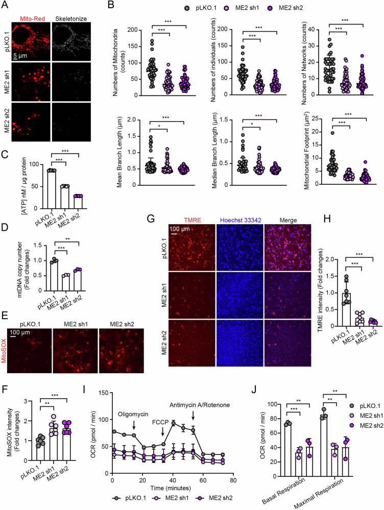Malic enzyme 2 (ME2) deficiency induces mitochondrial morphological abnormalities and impairs mitochondrial function. A, B, Mitochondrial morphology visualized by MitoTracker Red staining in control and ME2-knockdown HepG2 cells. Mitochondrial networks were skeletonized and quantified using the Mitochondrial Network Analysis (MiNA) tool. n = 50. Scale bar, 5 um.