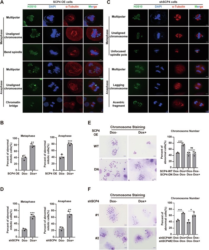 Aberrant expression of SCP4 leads to abnormal chromosome behavior during cell division. Cells were stained with anti-phospho-histone H3 (Ser10) (P-H3S10) antibody to visualize chromosomes and anti-α-tubulin antibody to visualize the mitotic spindle. Mitotic defects in metaphase include multipolar spindles, unaligned chromosomes, bent spindles, and unfocused spindle poles; anaphase defects include chromatin bridge and lagging chromosomes. Scale bars: 5 µm. (human (HeLa cells); Figure 4, panels A-D (control and SCP4 OE/KD HeLa cells at metaphase and anaphase; anti-alpha-tubulin spindle + P-H3S10 chromosomes).)