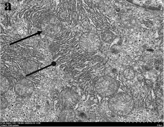 ST2 blockade is associated with improved hepatocyte ultrastructure and altered innate immune infiltration. Transmission electron microscopy (TEM) of liver tissues from control, AE-infected and anti-ST2-treated mice. a--c, Mitochondrial ultrastructure in hepatocytes. d--f, Nuclear morphology and immune cell infiltration. Black straight arrows indicate mitochondria; black circle-tipped arrows indicate cytoplasmic disorganisation; white straight arrows indicate neutrophils; white circle-tipped arrows indicate monocytes. Scale bars: 2.0 µm (a--c, 7,000x); 5.0 µm (d--f, 2,000x) (mouse (C57BL/6, liver hepatocyte, uninfected control); Fig. 6, a (control mouse, top-left panel; rows 0-411, cols 1-530 of figure).)