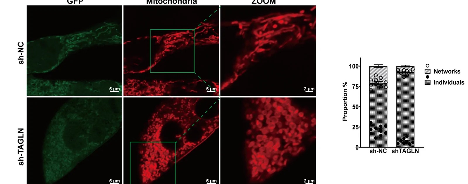 TAGLN knockdown alters mitochondrial morphology and energy metabolism in HBV-infected cells. (A) Confocal microscopic visualization of mitochondrial morphology in sh-TAGLN cells. Mitochondria were labeled with Mito Tracker Red (red), and GFP (green) served as a transfection marker. Adapted: confocal IF panel A only; quantification panels B-D, Western blot panel E, and functional panels F-I excluded. (human (HBV-infected hepatocytes, sh-TAGLN); Figure 4, panel A only (confocal IF of MitoTracker Red; quantification and WB panels B-I excluded; rows 90-720 of full figure, 1600x630).)