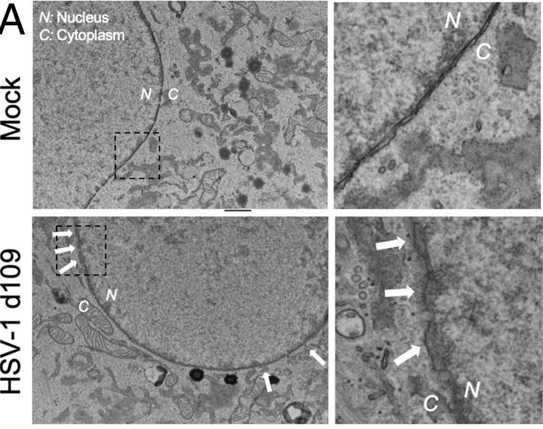 Ultrastructural characterization of nuclear DNA blebs by TEM. ( A ) Positive staining in mock-infected and HSV-1 d 109-infected HFF cells at 3 hpi (MOI = 5 pfu/cell) visualized by transmission electron microscopy (TEM). White arrows point to nuclear envelope membrane separations. Direct magnification was 4,800x, where one pixel is 1.46 nm. The scale bar represents 1 um. (human (HFF fibroblast, mock-infected control); Figure 4A (mock-infected control, left panel).)