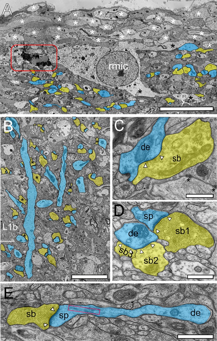 Transmission electron microscopy of synaptic boutons (SBs) in layer 1 (L1) of the human temporal lobe neocortex (TLN). Panel A shows the superficial part of L1a composed of a dense network of mostly unmyelinated axons, dendritic processes, and synaptic boutons. Asymmetric (excitatory) synapses with post-synaptic densities (PSDs) and presynaptic vesicle pools are visible alongside mitochondria and cytoskeletal elements within the neuropil. (human (post-mortem temporal lobe neocortex, layer 1); Figure 2, A.)