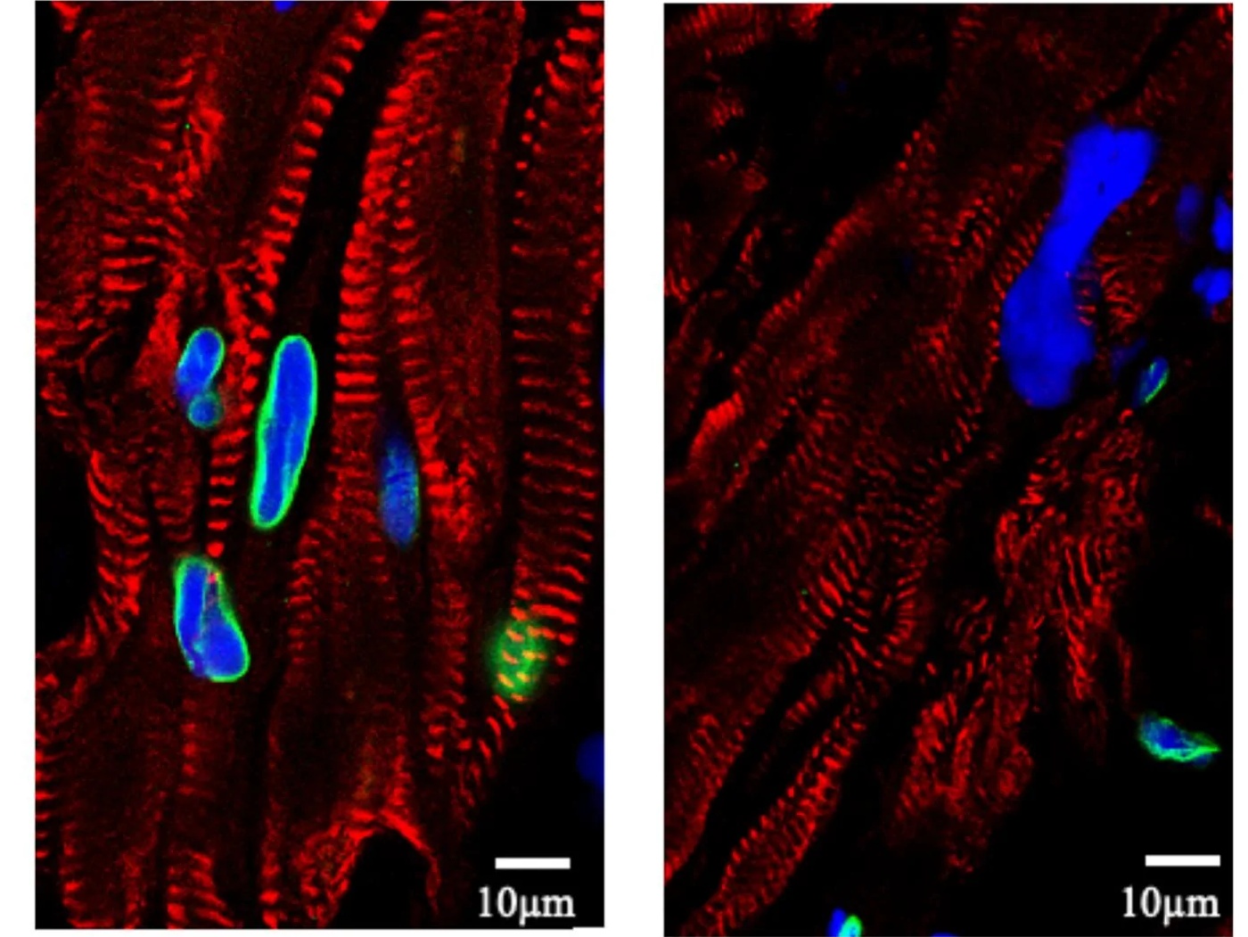 Representative confocal images of immunofluorescence-stained sections of human myocardium: lamin B1 (green), DAPI (blue), and sarcomeric alpha-actinin (red). A) cardiomyocyte nuclei. (human; Fig. 2, panel A (cardiomyocyte nuclei IF; rows 142-1193 of figure).)