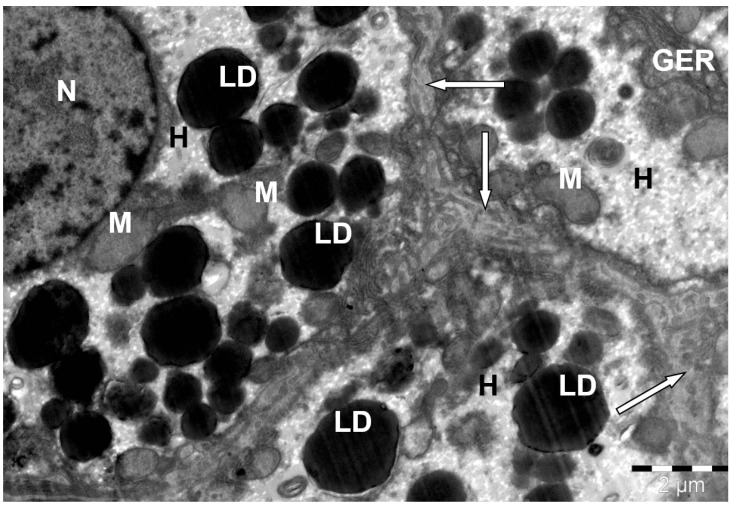Structure of a camel liver hepatocyte. H--hepatocyte; N--nucleus; LD--lipid droplets; M--mitochondria; GER--granular endoplasmic reticulum channels; sinusoidal capillaries (↑). Electron microphotography. (Bactrian camel (Camelus bactrianus, liver hepatocyte); Figure 8single.)